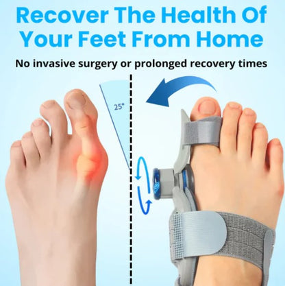 MelloTouch™ Natural Relief for Bunion Pain