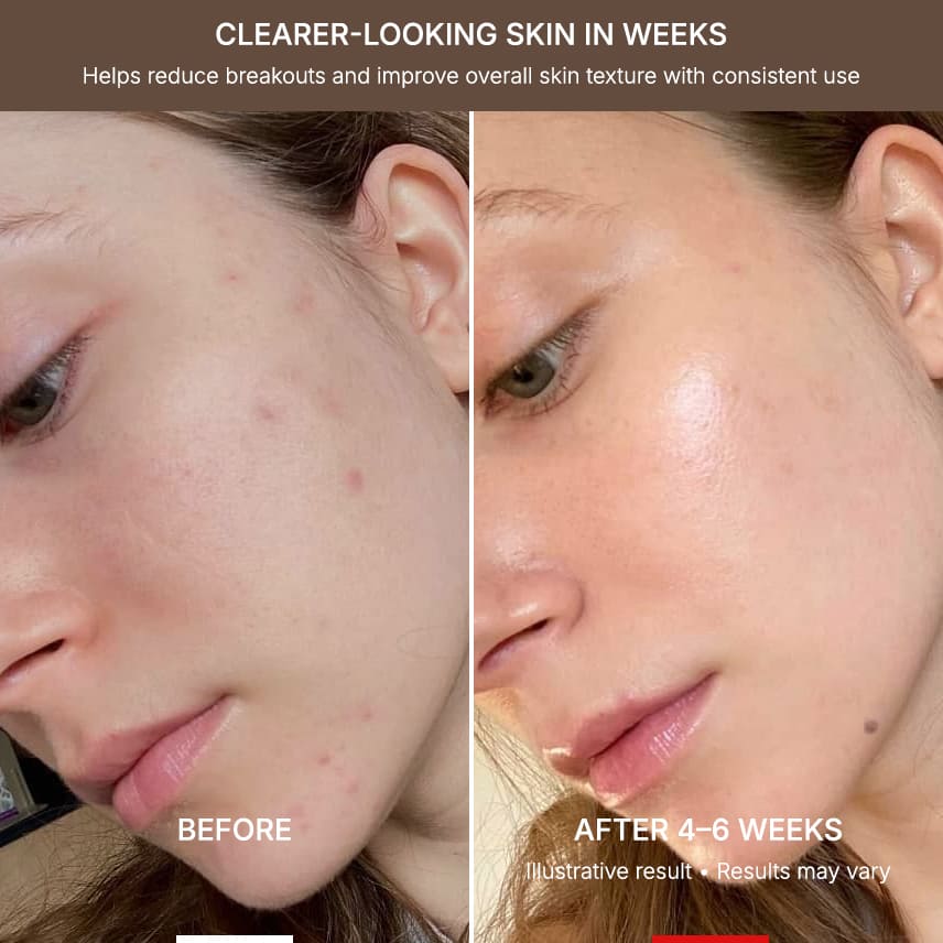 MelloTouch™ Flex LED Face + Neck Mask