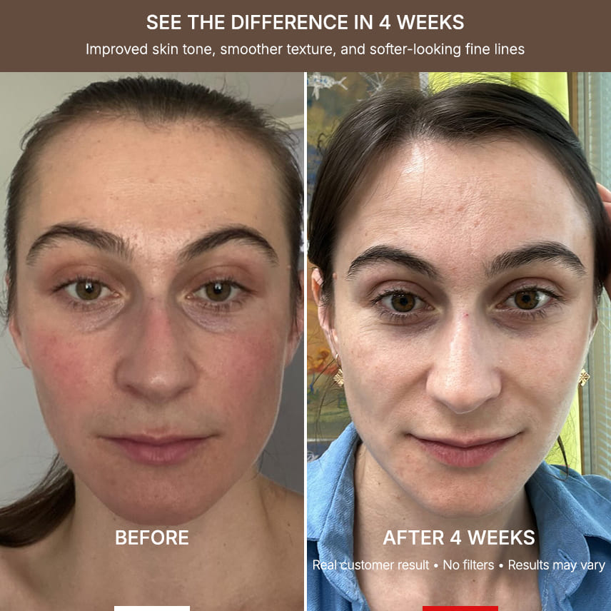 MelloTouch™ Flex LED Face + Neck Mask