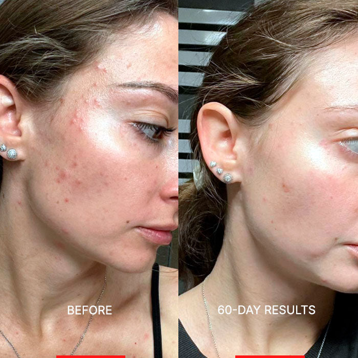 MelloTouch™ Aura Mask