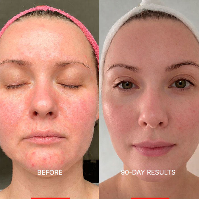 MelloTouch™ Aura Mask