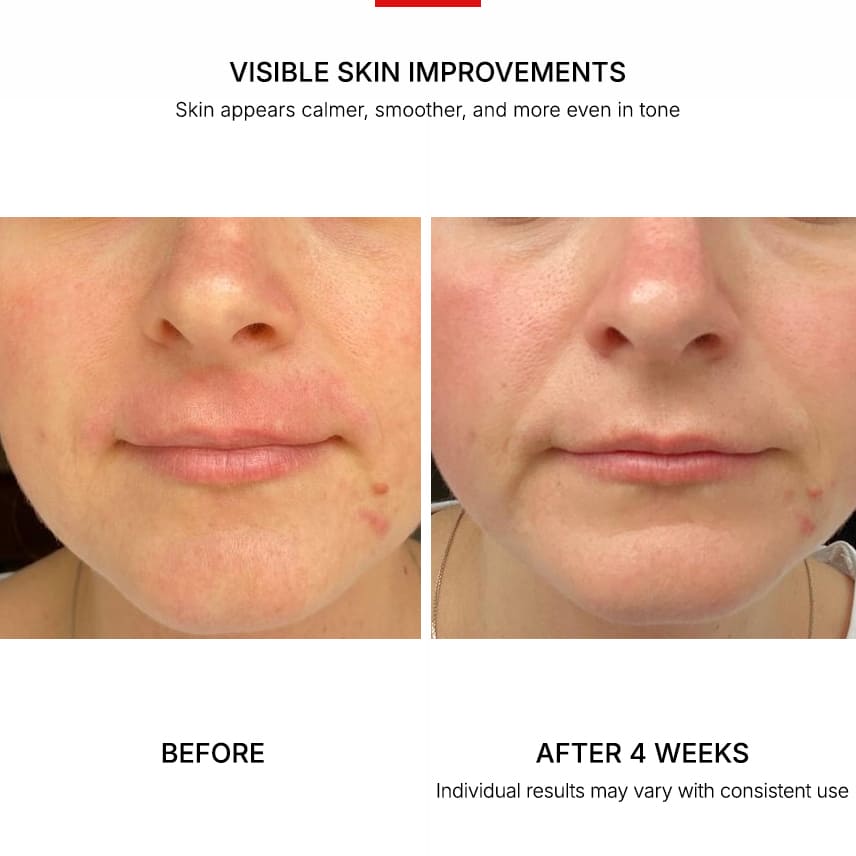 MelloTouch™ Aura LED Mask