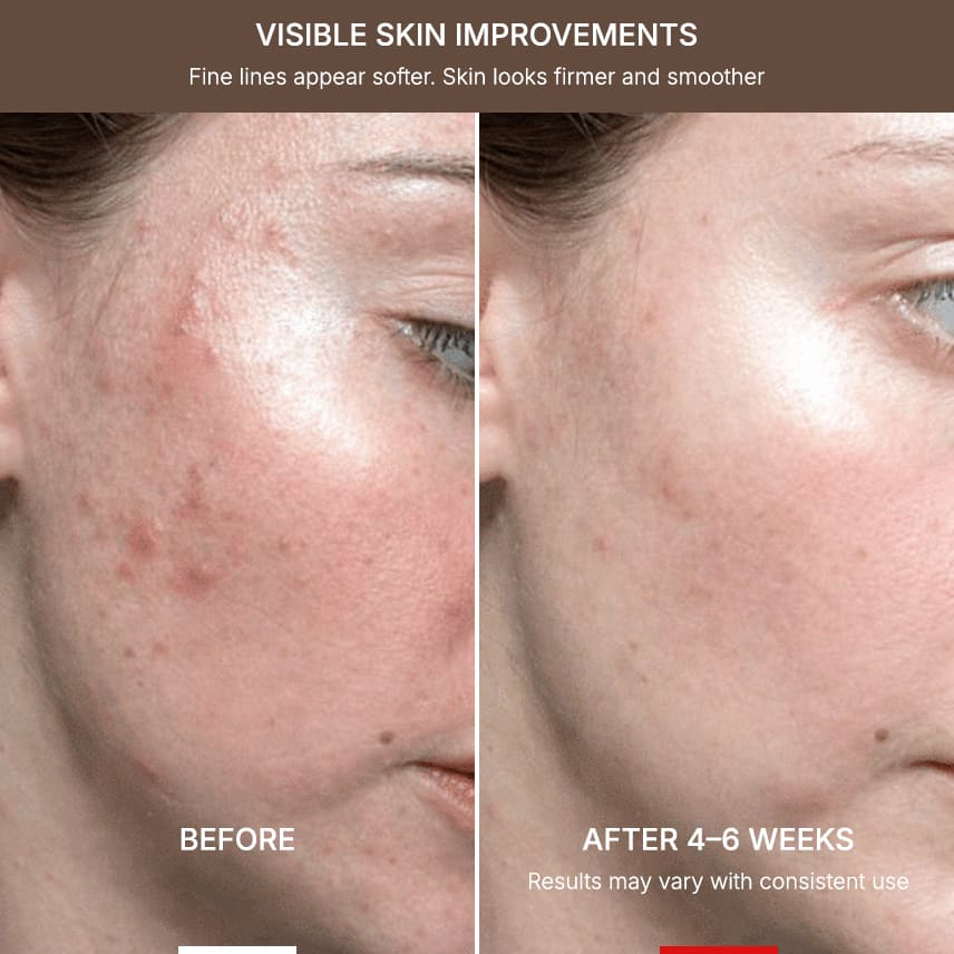 MelloTouch™ Aura LED Mask